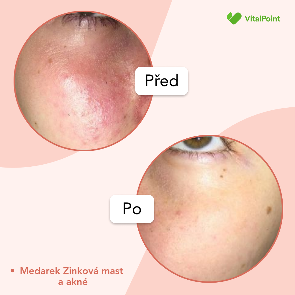 Medarek Zinková masť BIO 30 ml